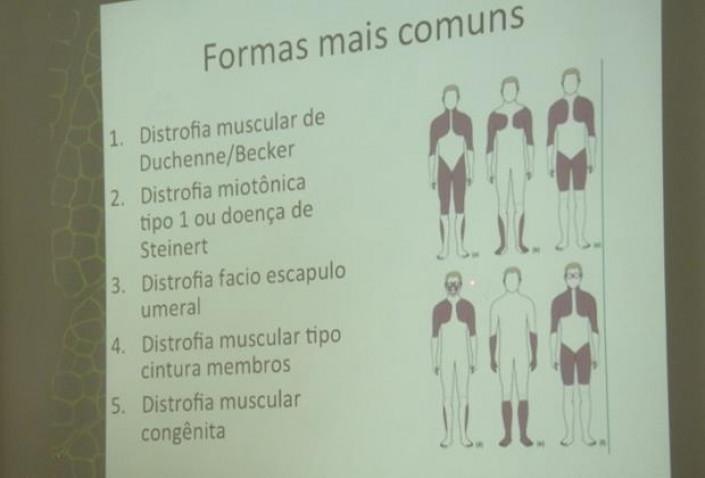 Bahiana-Distrofias-Musculares-Discussao-16-07-16_(11).jpg